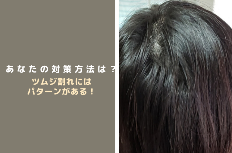 つむじ割れについての説明です。